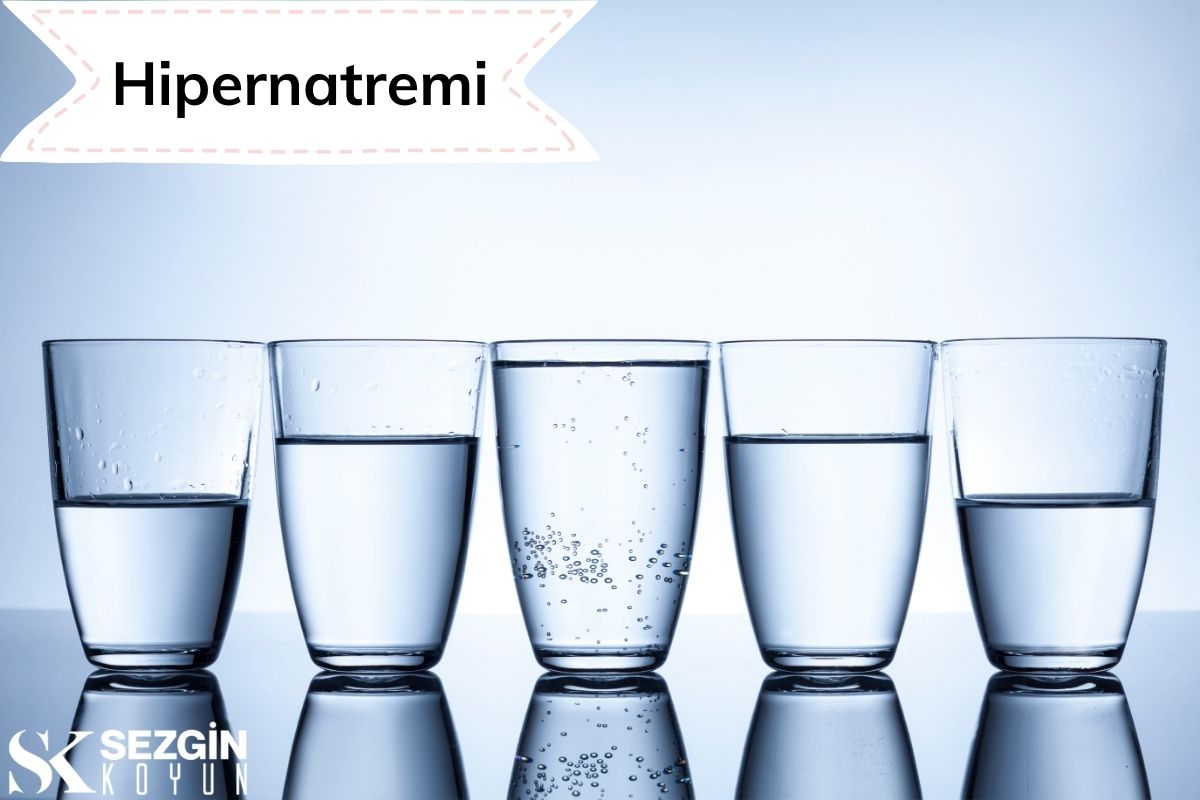 Hipernatremi: Tanımı, Nedenleri, Belirtileri ve Tedavisi