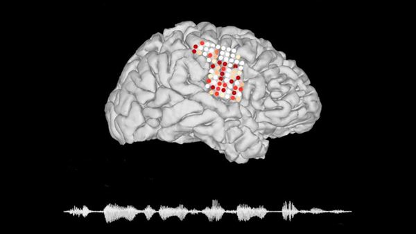 Beyin sinyallerini sese dönüştüren implant geliştirildi